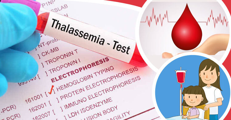 বিবাহ পূর্ব থ্যালাসেমিয়া রোগের পরীক্ষা এখন সময়ের দাবি